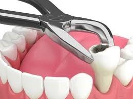 Trusted Pediatric Dentist in Newtown