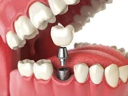 Trusted Pediatric Dentist in Newtown