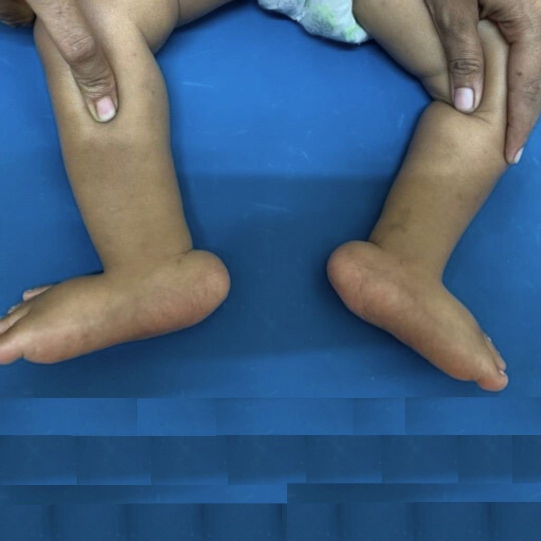 Post Feature Image