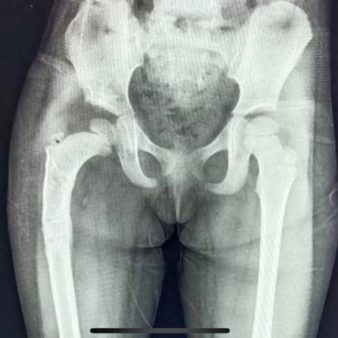 Post Feature Image