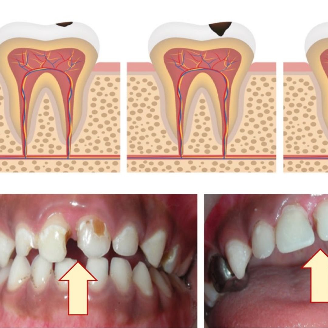 Post Feature Image