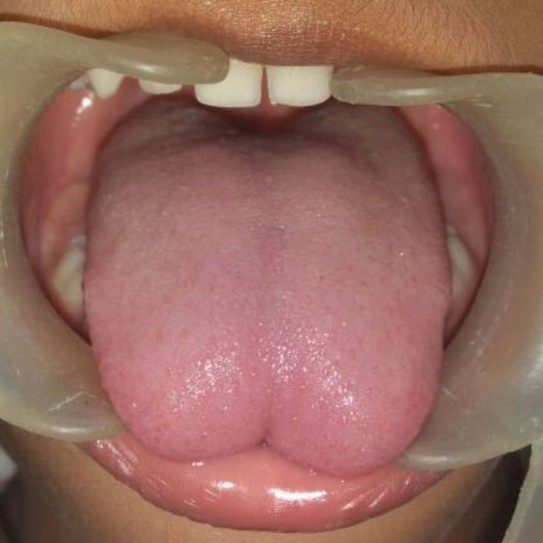 Post Feature Image
