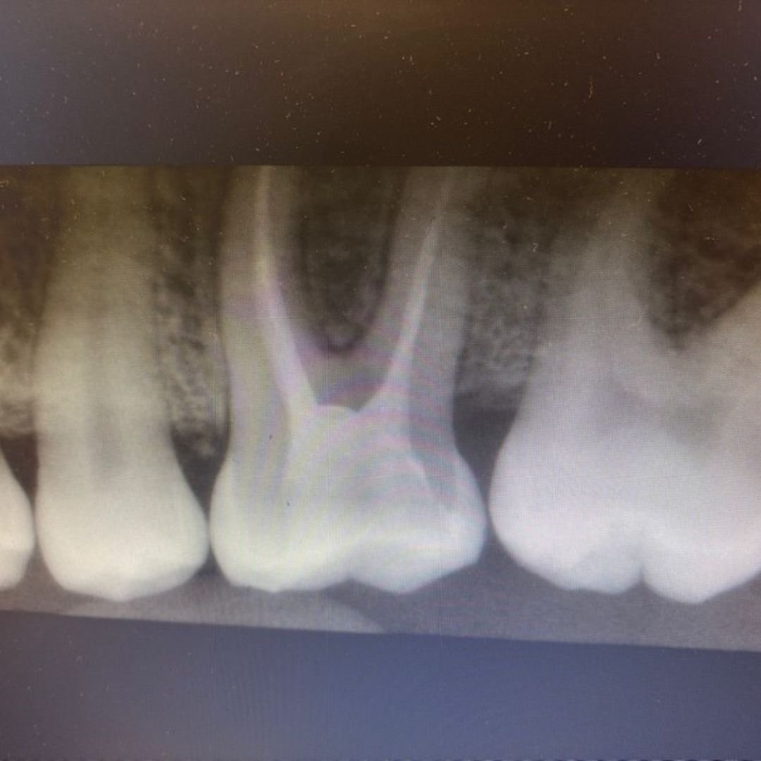 Post Feature Image