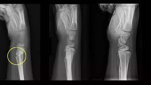 best Pediatric Orthopedic surgeon in Kolkata