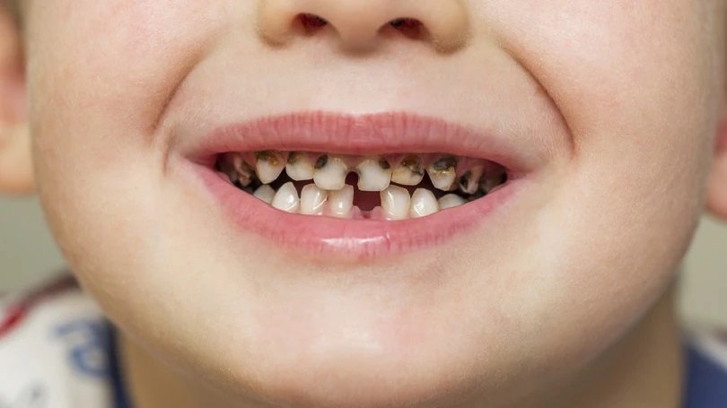 best kids dentist in Newtown