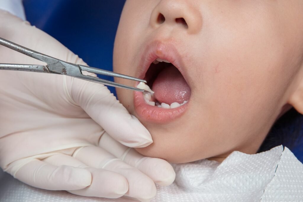 Dental Surgery & Tooth Extraction